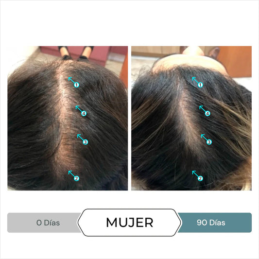 DS LABS Revita.SOD Suplemento Alimenticio para el Crecimiento del Cabello 30 tabletas