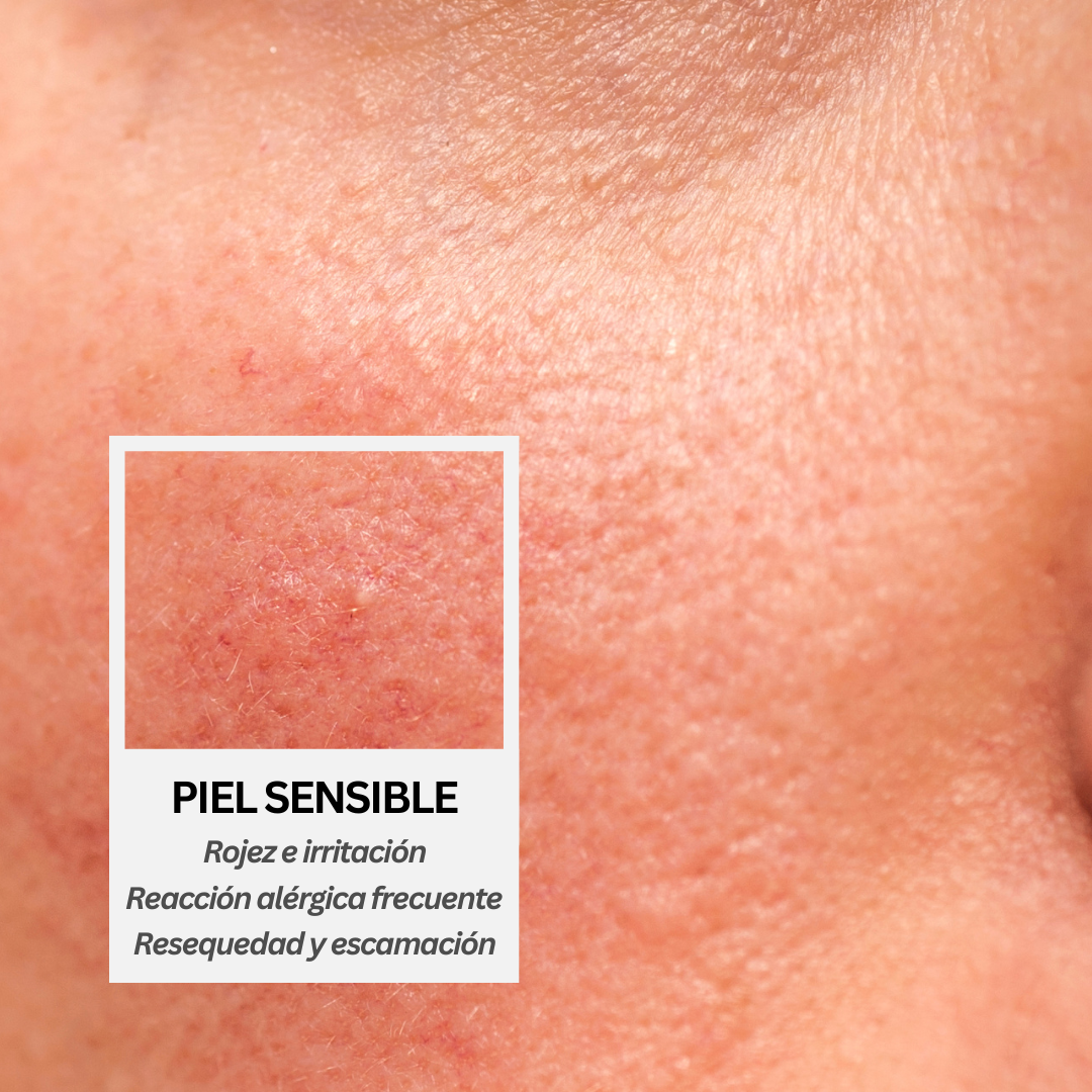 PIEL SENSIBLE