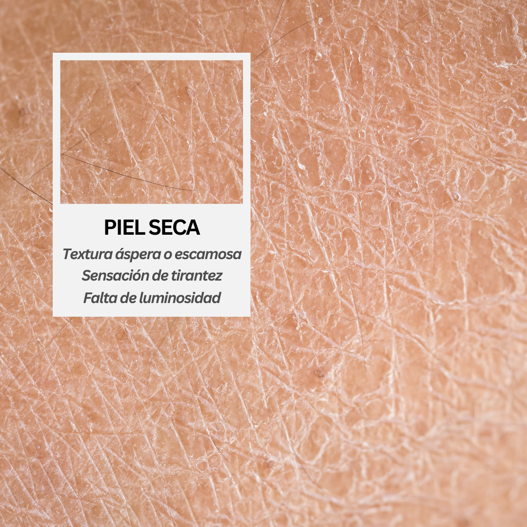 PIEL SECA
