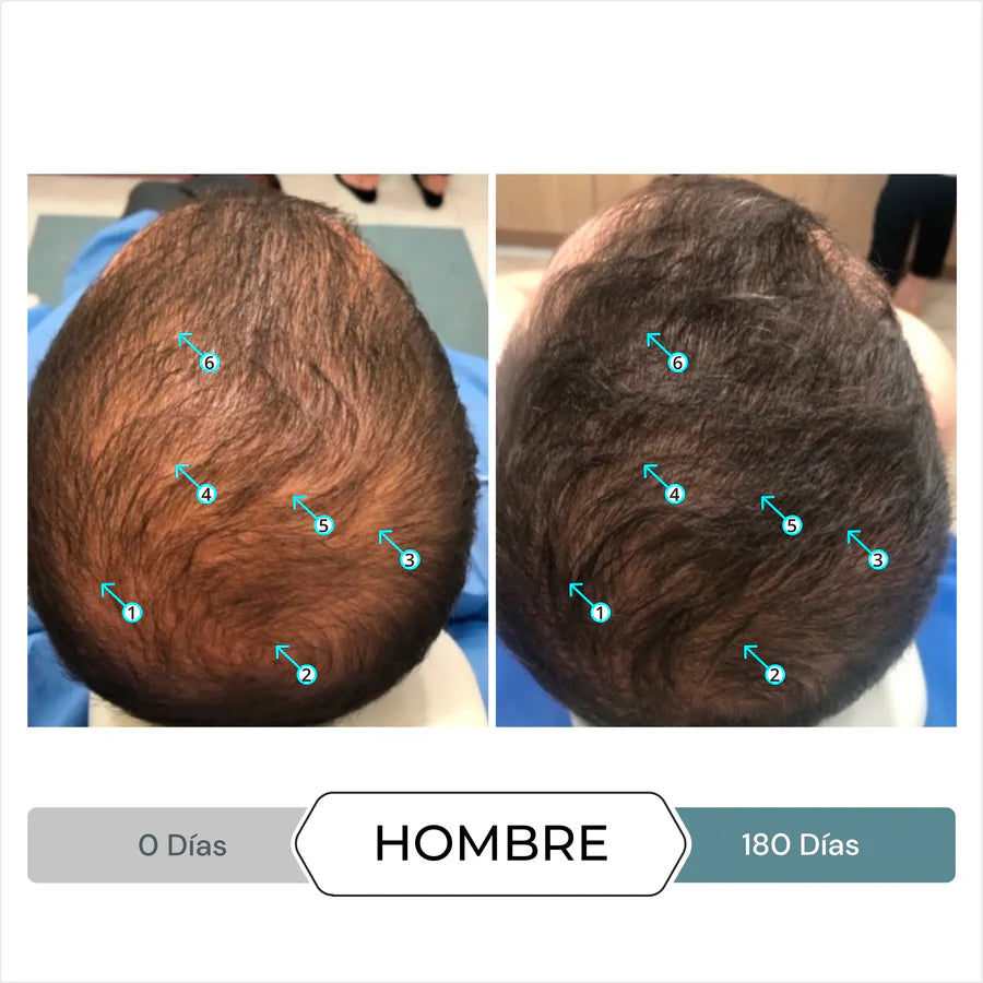 DS LABS Revita.SOD Suplemento Alimenticio para el Crecimiento del Cabello 30 tabletas