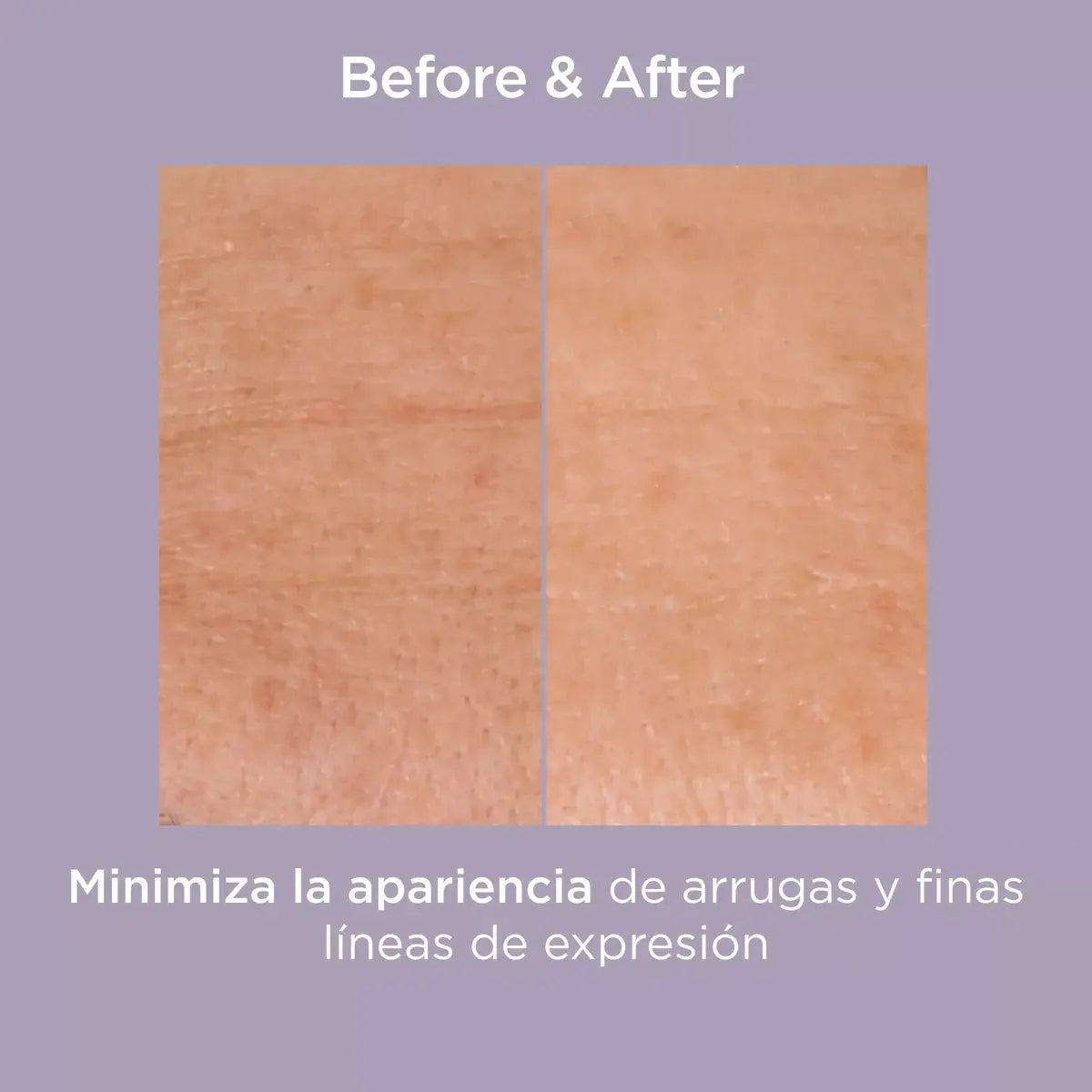 ISDINCEUTICS GLICOISDIN 25% INTENSE GEL  PEELING 50 GR